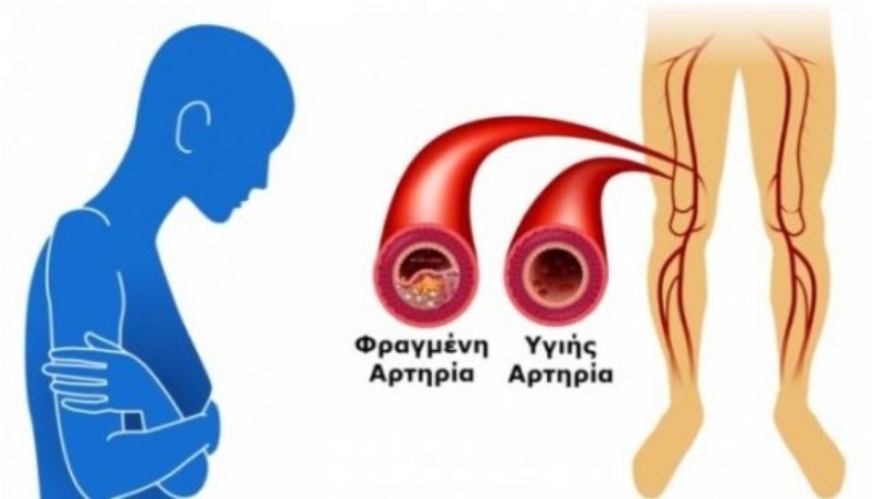 ε5δξρτχηε