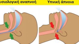 ipniki-apnoia-epiptoseis-soma-8211-poioi-kindineuoun-perissotero-8211-antimetopisete-670×400